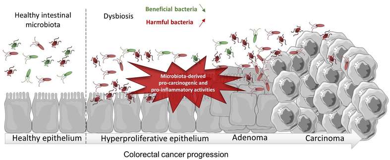 대장암 원인, 증상, 예방 및 좋은 음식
