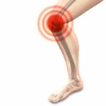 퇴행성 관절염 원인, 증상 및 예방과 좋은 음식