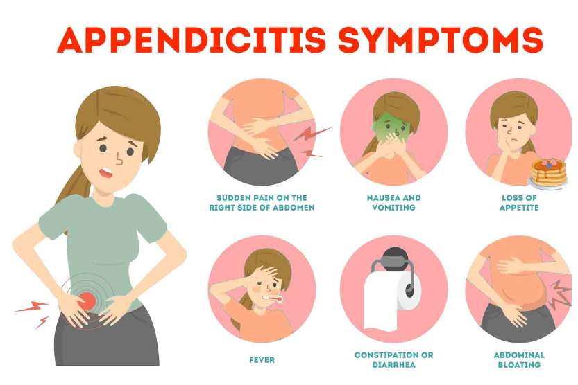 충수염 원인, 증상, 예방 및 좋은 음식