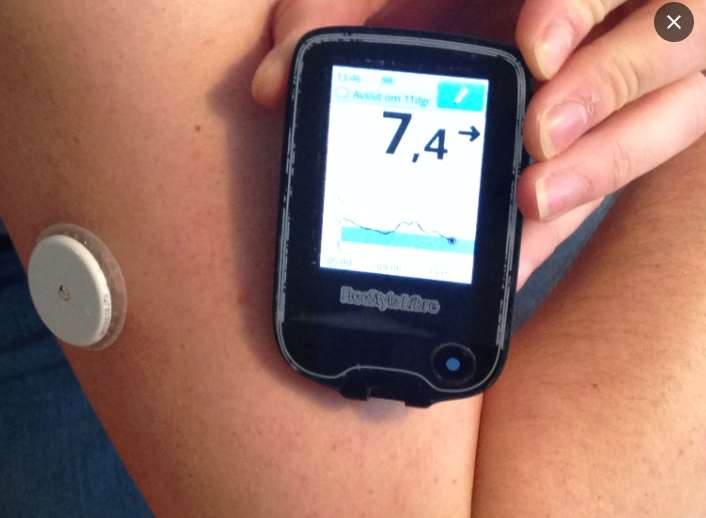 연속혈당측정기 원리, 종류, 보험, 장점 및 단점 한방에 정리