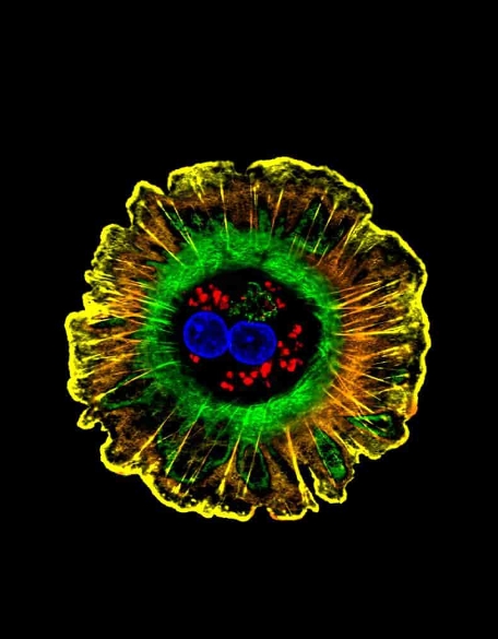 담도암(담관암)이해하기:증상, 원인, 진단, 치료의 진실 확인하기