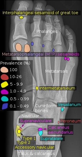발바닥 통증이 고민이신가요? 부위(앞쪽,뒤쪽,가운데), 원인, 통풍, 치료법 및 완화를위한 마사지 기술