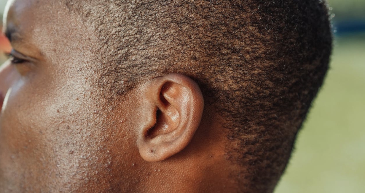 얼굴 닭살 원인과 해결 방법, 집에서 쉽게 따라해 보세요!