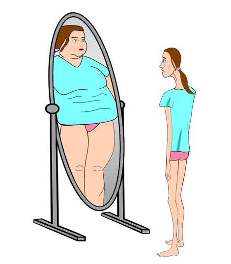음식물 과민증 검사