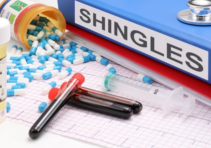 대상포진 면역력을 자연적으로 강화하는 5가지 방안