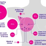 유방암 원인,초기증상,예방 및 좋은 음식