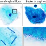 여성 건강을 위한 질 유산균의 효능