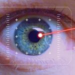 시력 교정술이란 무엇인가요?