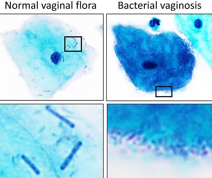 여성 건강을 위한 질 유산균의 효능